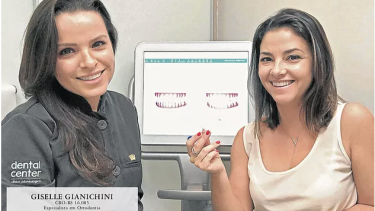 Matéria com a Dra Giselle na Revista Donna ZH –  Invisalign e iTero