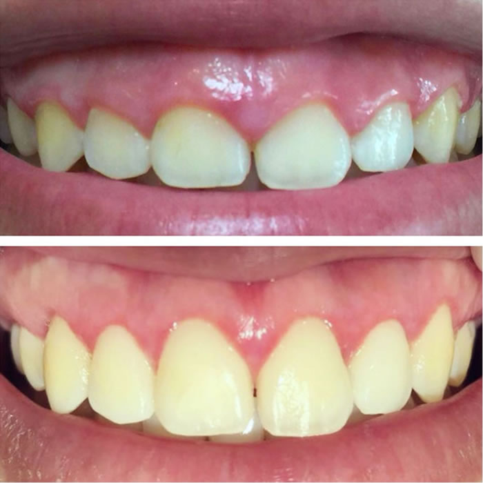 Cirurgias Estéticas, Dentista Porto ALegre